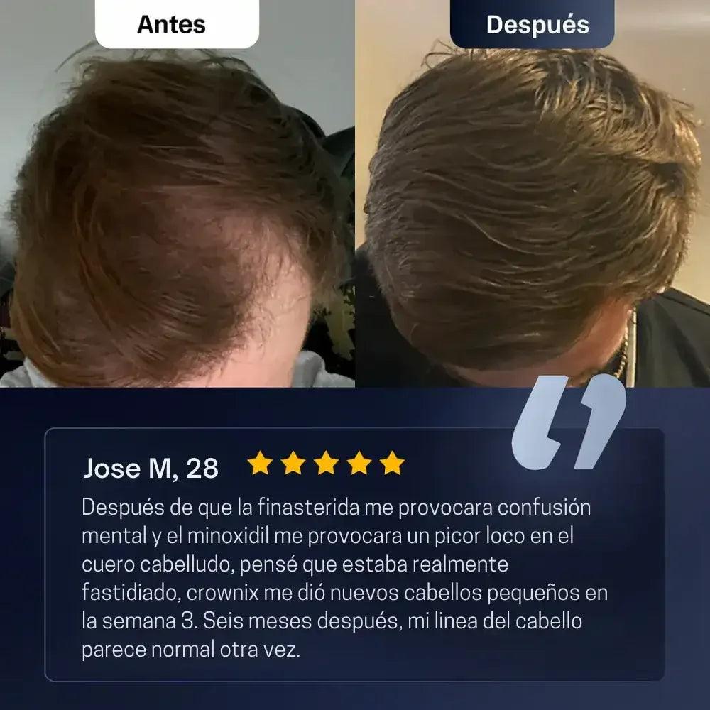 BODYWISE Roll-On de Crecimiento Capilar™