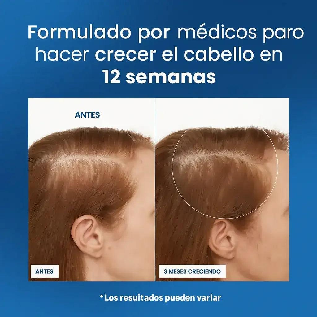 BODYWISE Roll-On de Crecimiento Capilar™